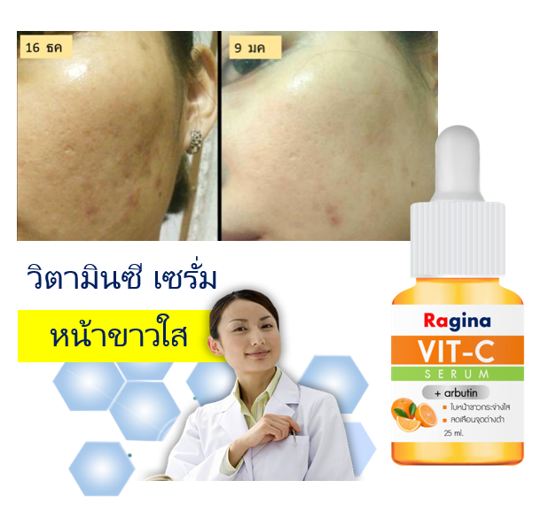 วิตามินซี เซรั่ม หน้าขาวใส รักษาฝ้า ลบจุดด่างดำ รักษาสิว