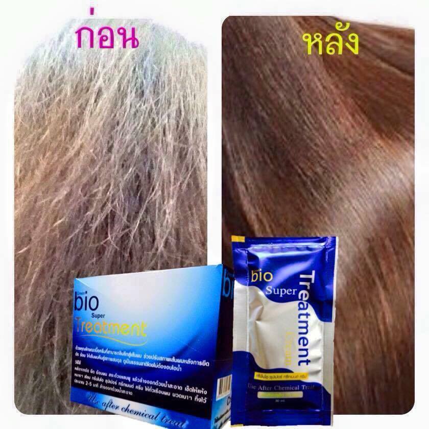 ไบโอทริทเม้นต์รู้แล้วต้องลอง