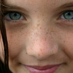 วิธีทำให้หน้าขาวใส การรักษาฝ้า กระ ลบจุดด่างดำ ลบรอยดำจากสิว